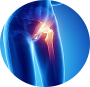 Stem Cells for Hip Pain - Advanced Stem Cells NJ